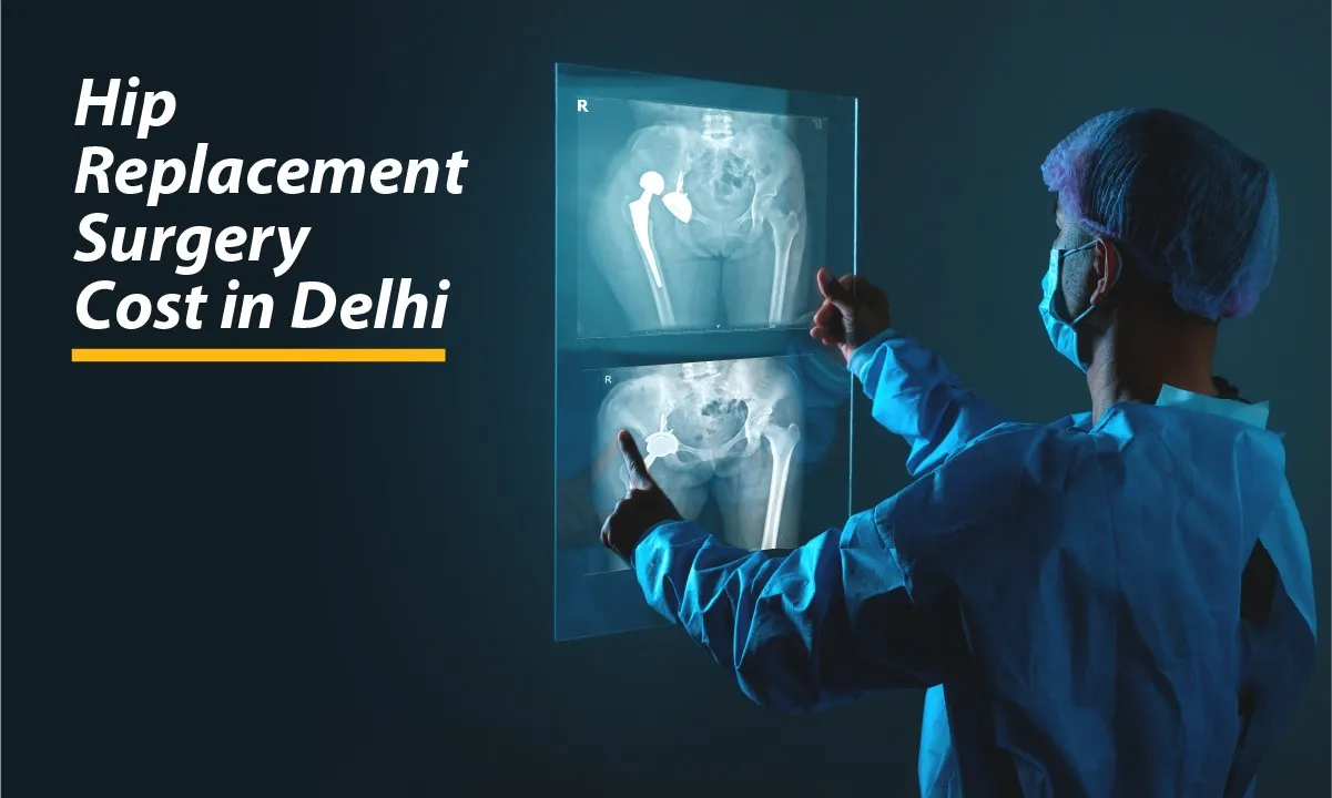 Hip Replacement Surgery Cost in Delhi